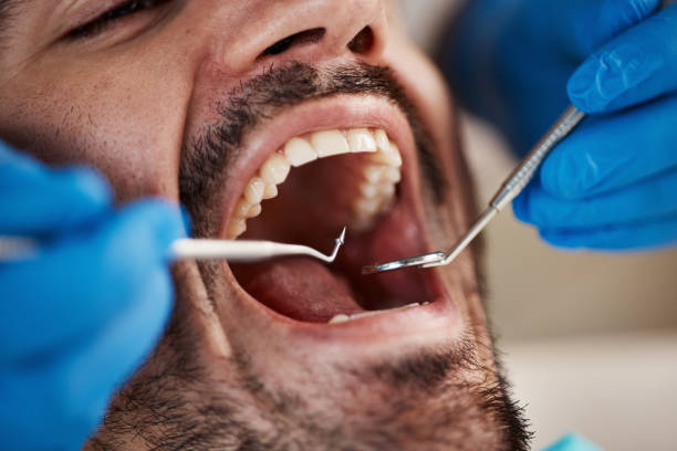 Best Emergency Broken Tooth Repair in Waterville, OH